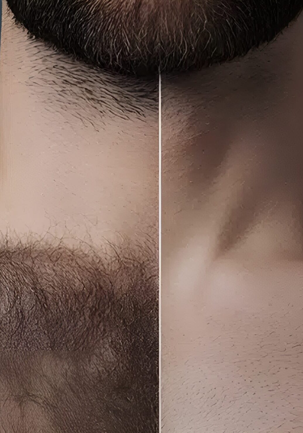 Portland laser hair removal for men at Cosmetiq Medicine