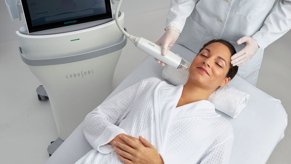 Potenza microneedling Portland