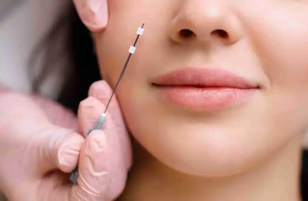 face lift Portland - PDO thread lift appointments at Cosmetiq Medicine MedSpa